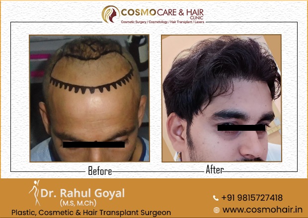 Top Hair Loss Doctors in Chandigarh - Best Hair Specialist Doctor near me -  Justdial