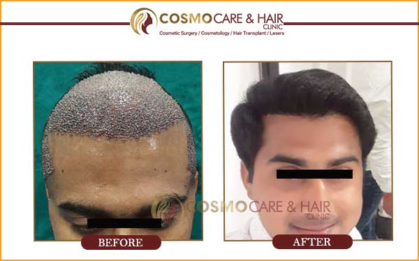 Dr Naiya Bansals Skin Laser Hair Transplant Clinic in Sector 40d,Chandigarh  - Book Appointment Online - Best Beauty Clinics For Laser Treatment in  Chandigarh - Justdial