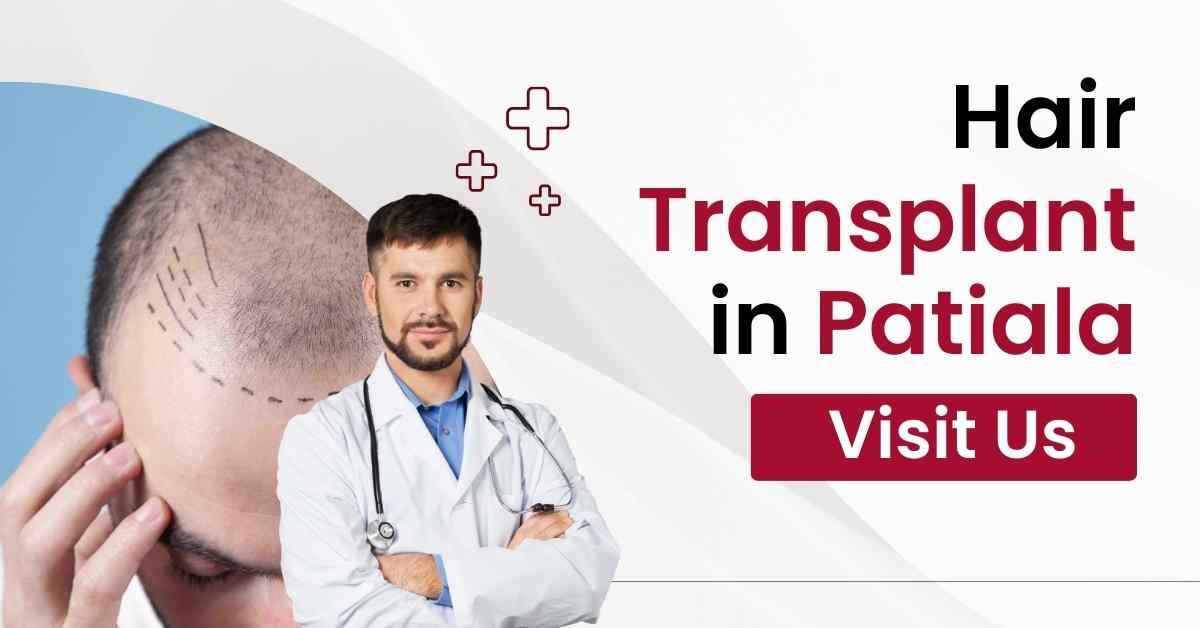 Hair Transplant in Patiala
