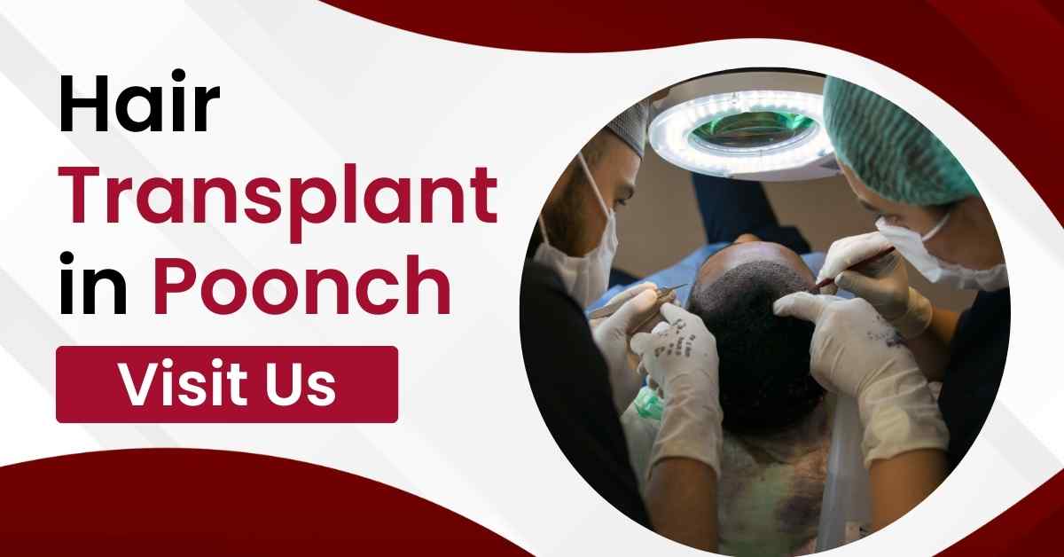 Hair Transplant in Poonch