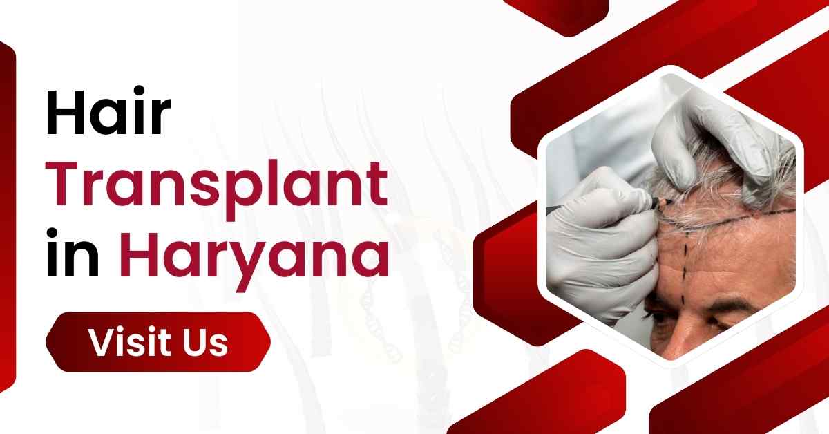 Hair Transplant in Haryana