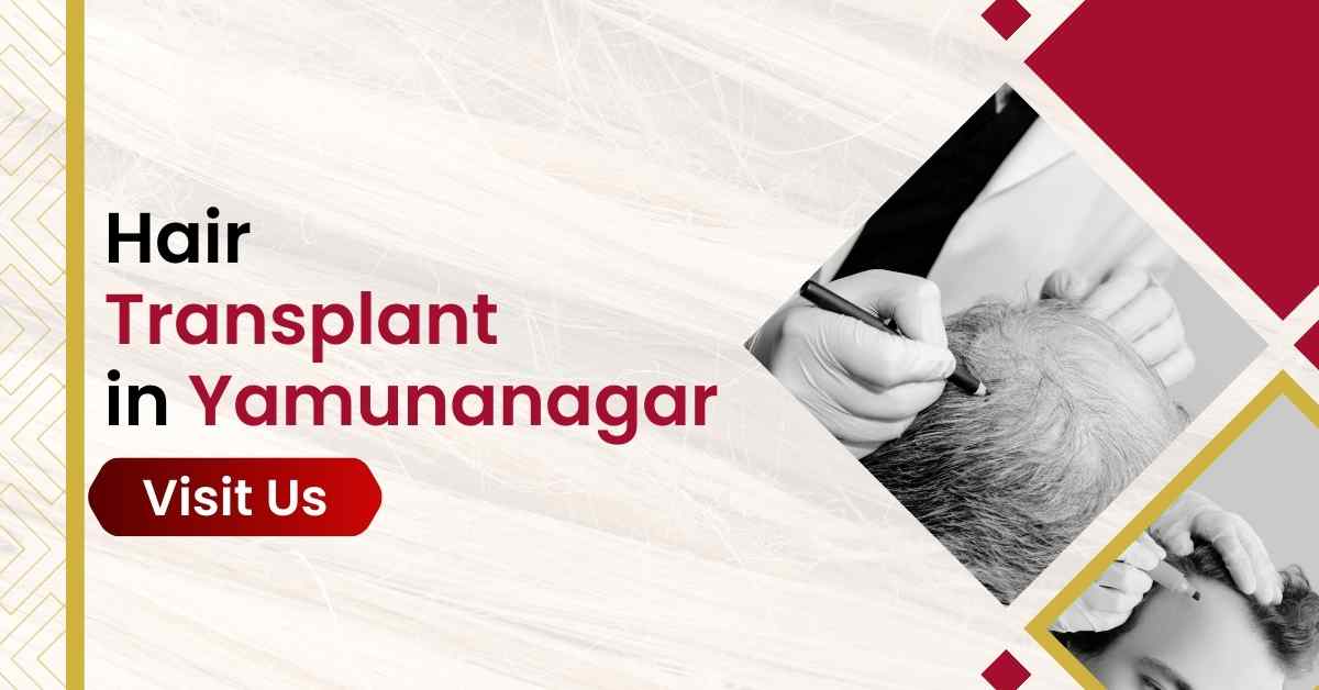 Hair Transplant in Yamunanagar