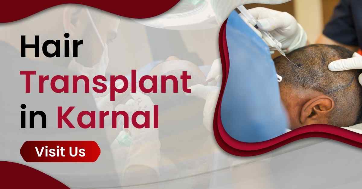 Hair Transplant in Karnal