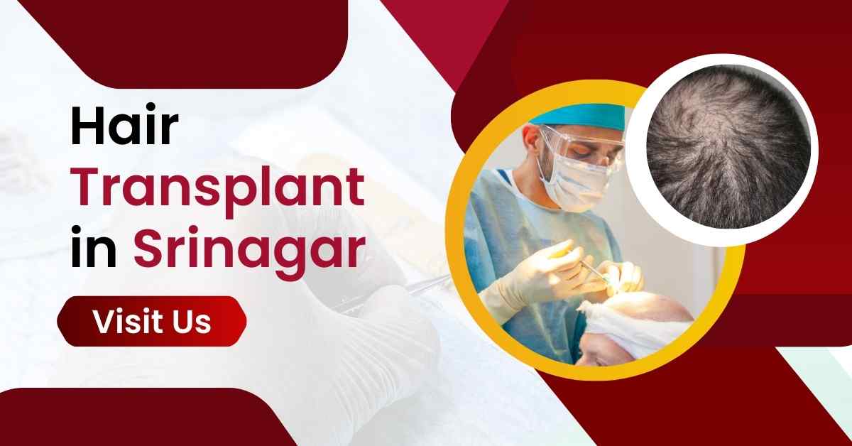 Hair Transplant in Srinagar