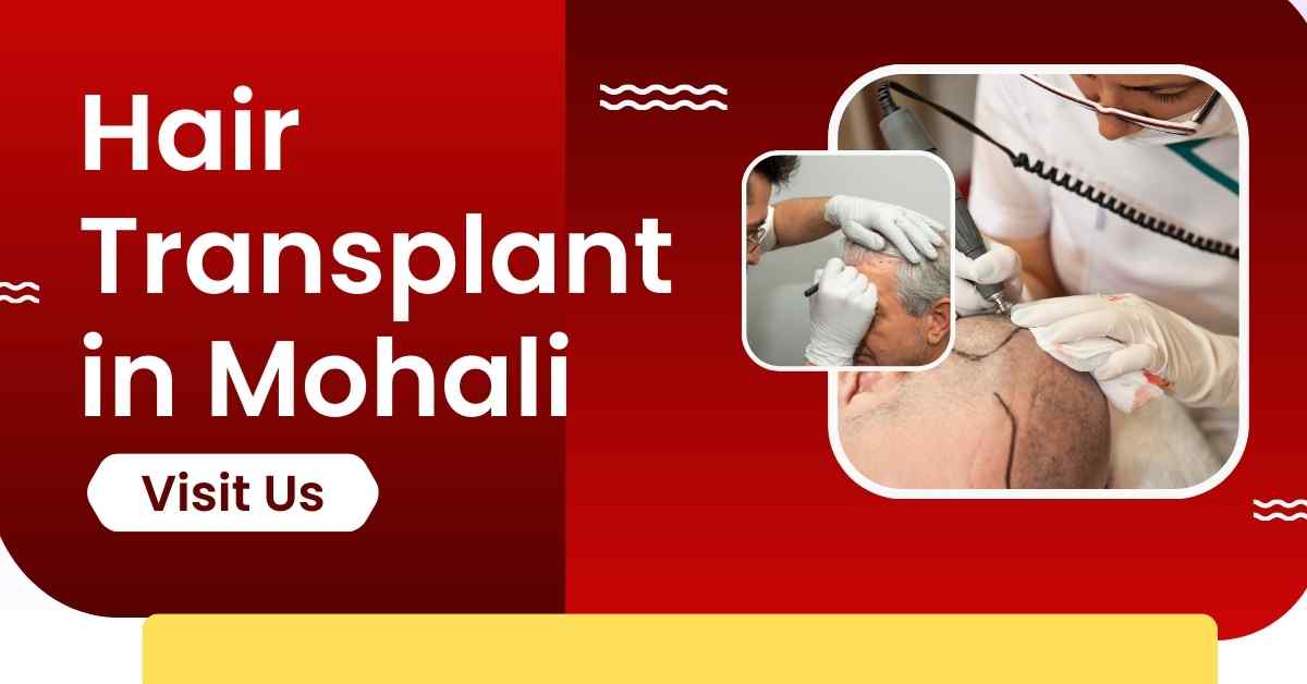 Hair Transplant in Mohali