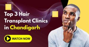 Read more about the article Top 3 Hair Transplant Clinics in Chandigarh