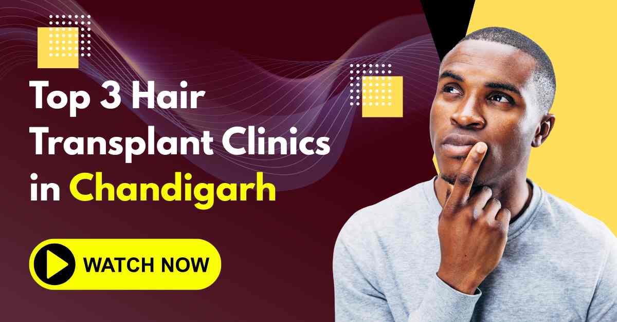 Top 3 Hair Transplant Clinics in Chandigarh