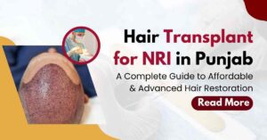 Hair Transplant for NRI in Punjab