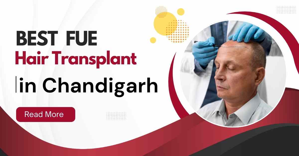 Best FUE Hair Transplant
