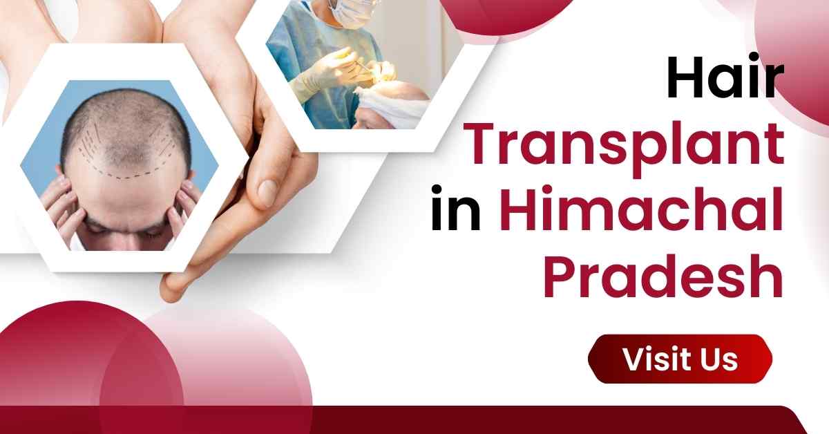 Hair Transplant in Himachal Pradesh