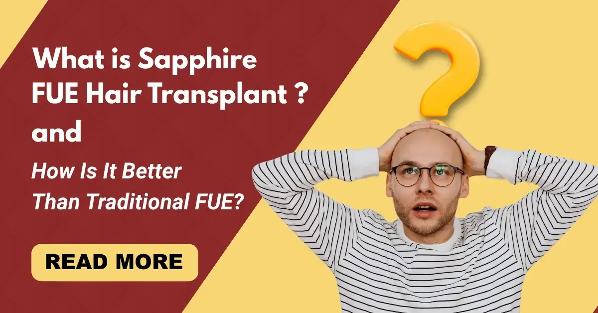 Read more about the article What is Sapphire FUE Hair Transplant and How Is It Better Than Traditional FUE? 