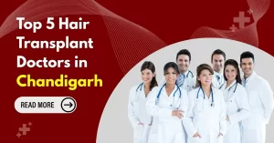 Hair Transplant Doctors in Chandigarh