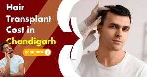 Read more about the article Hair Transplant Cost in Chandigarh — Factors That Affect Pricing