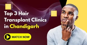 Top 3 Hair Transplant Clinics in Chandigarh