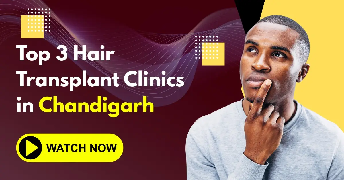 You are currently viewing Top 3 Hair Transplant Clinics in Chandigarh