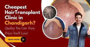 Cheapest Hair Transplant Clinic in Chandigarh