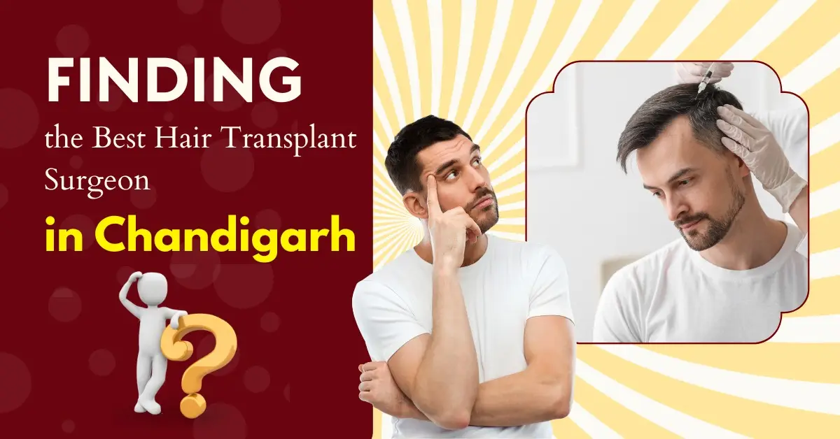 You are currently viewing Finding the Best Hair Transplant Surgeon in Chandigarh