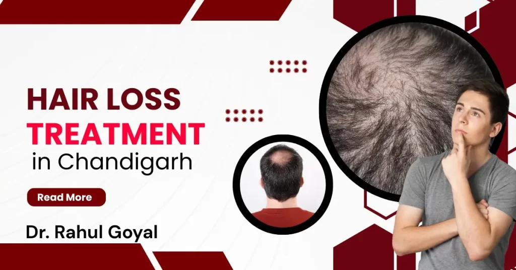 hair loss treatment in Chandigarh
