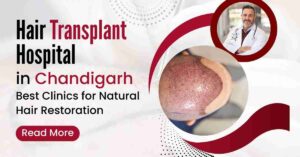 Hair Transplant Hospital in Chandigarh
