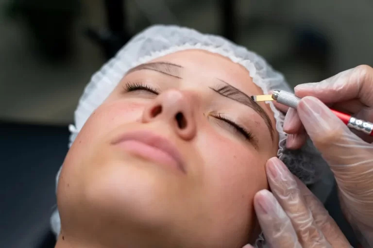 Eyebrow Hair Transplant in Chandigarh before after