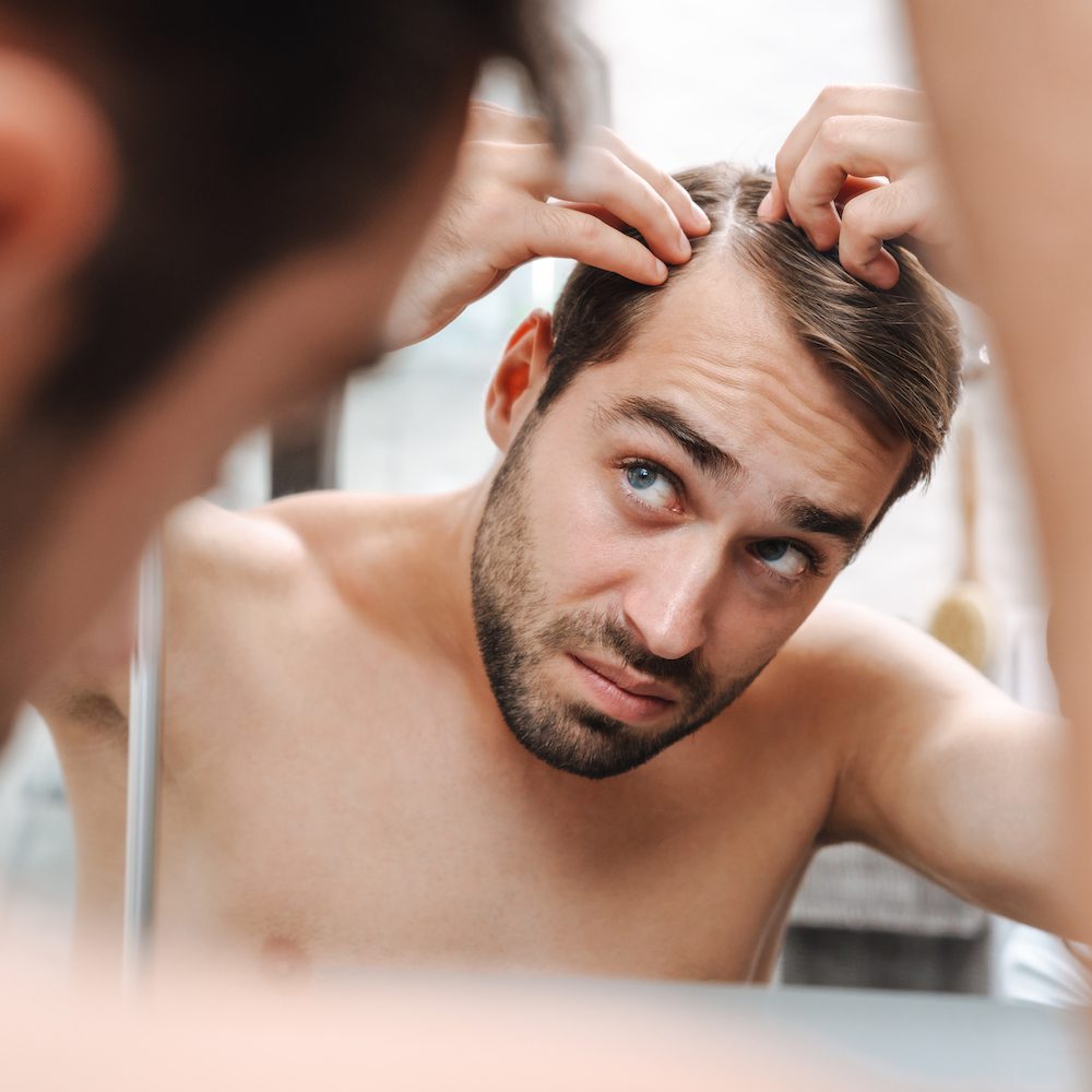 Hair loss stages