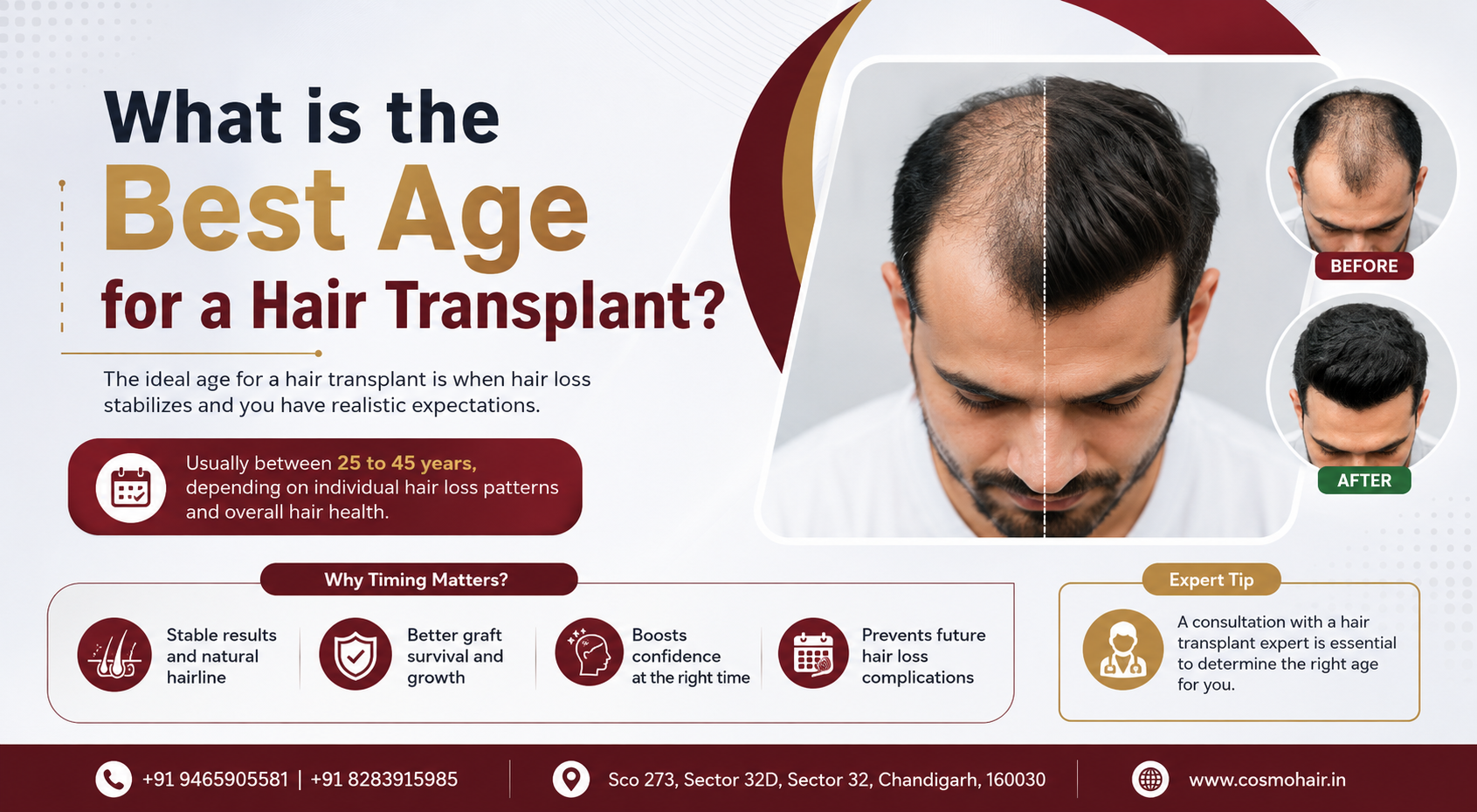 Hair Transplant