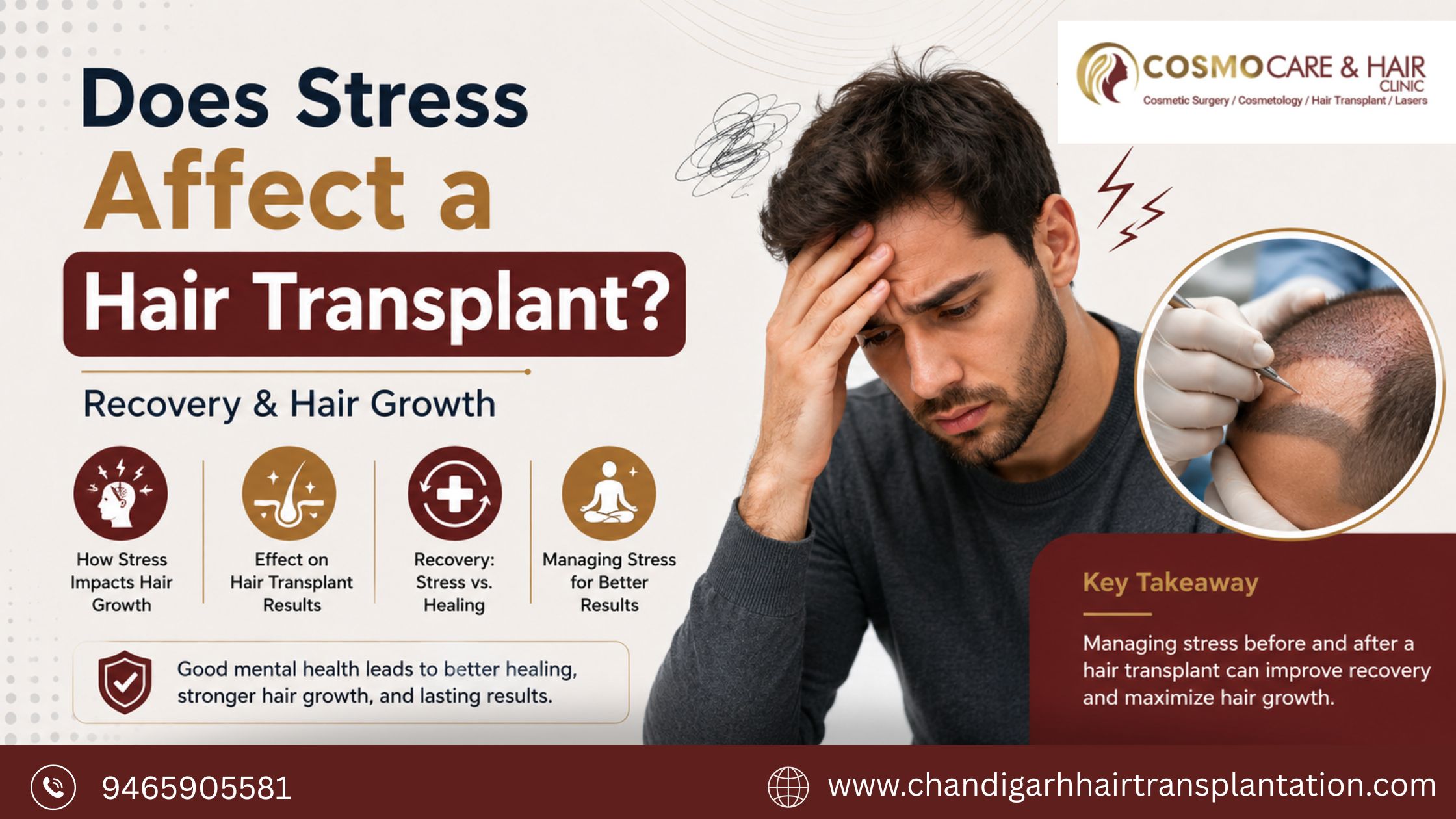 Does Stress Affect a Hair Transplant
